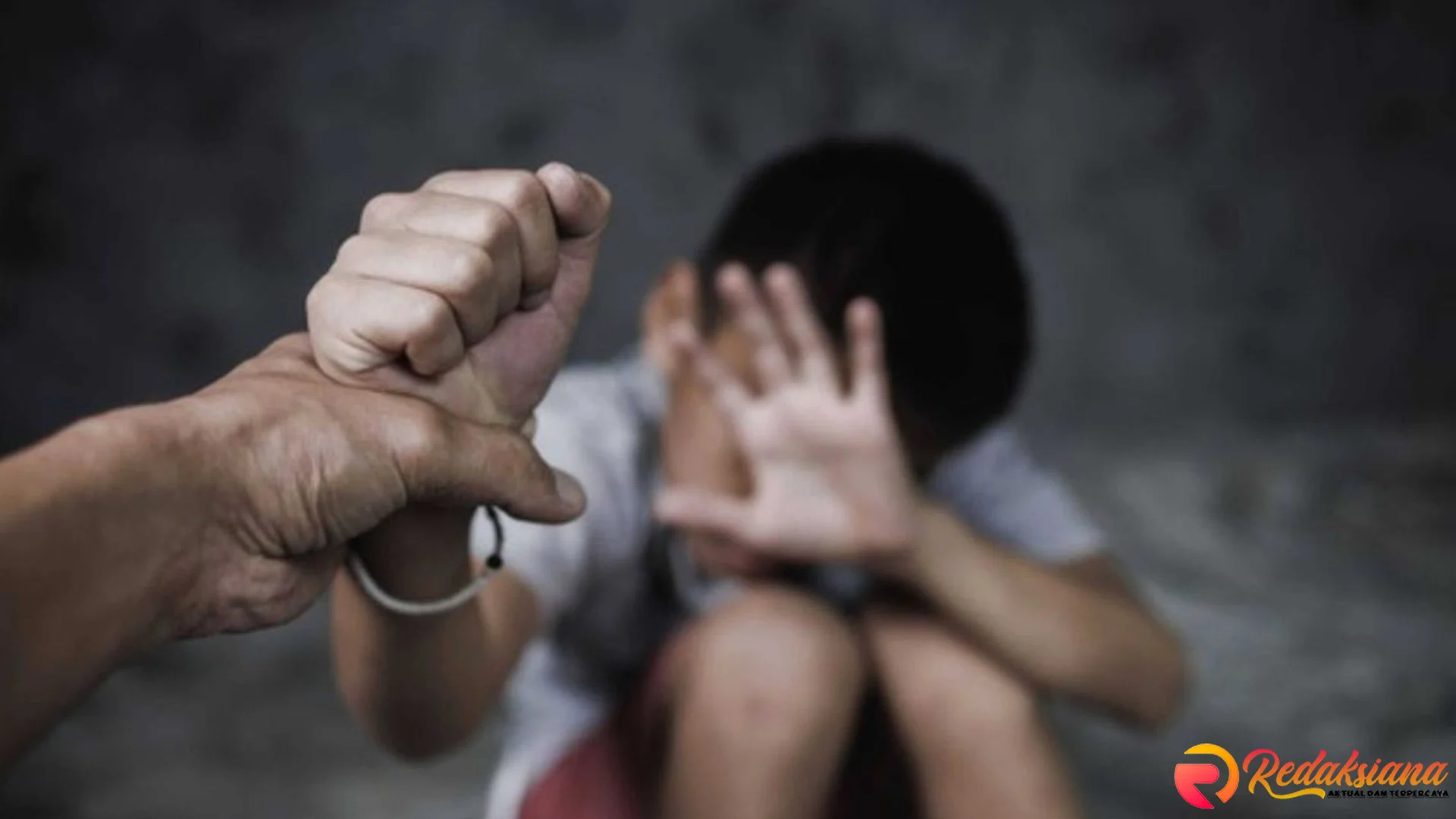 Gila Si Ayah Tiri! Di Bogor Bocah 3 Tahun Diderita Kepala Bocor Gitu